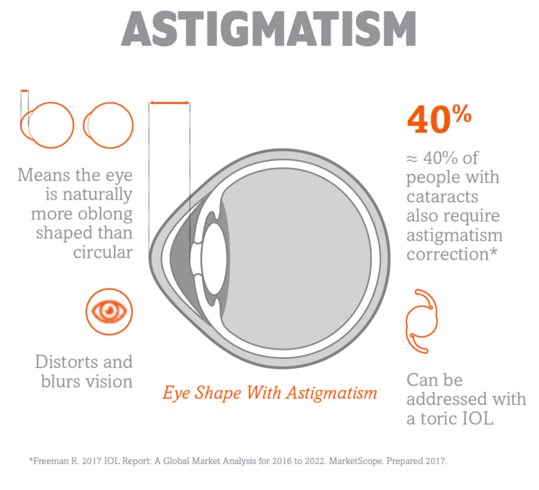 cataract-treatment-tulsa-cataract-surgery-bartlesville