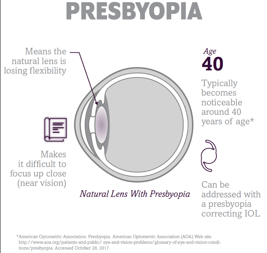 Illustrated diagram explaining presbyopia